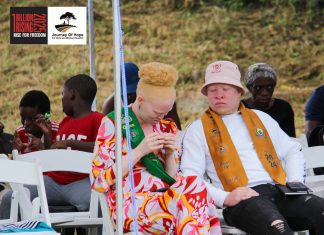 Eswatini’s Mr. and Miss Albinism Ready to Shine on Africa’s Biggest Stage